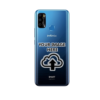 Infinix Smart 4 Plus Back Cover Customize